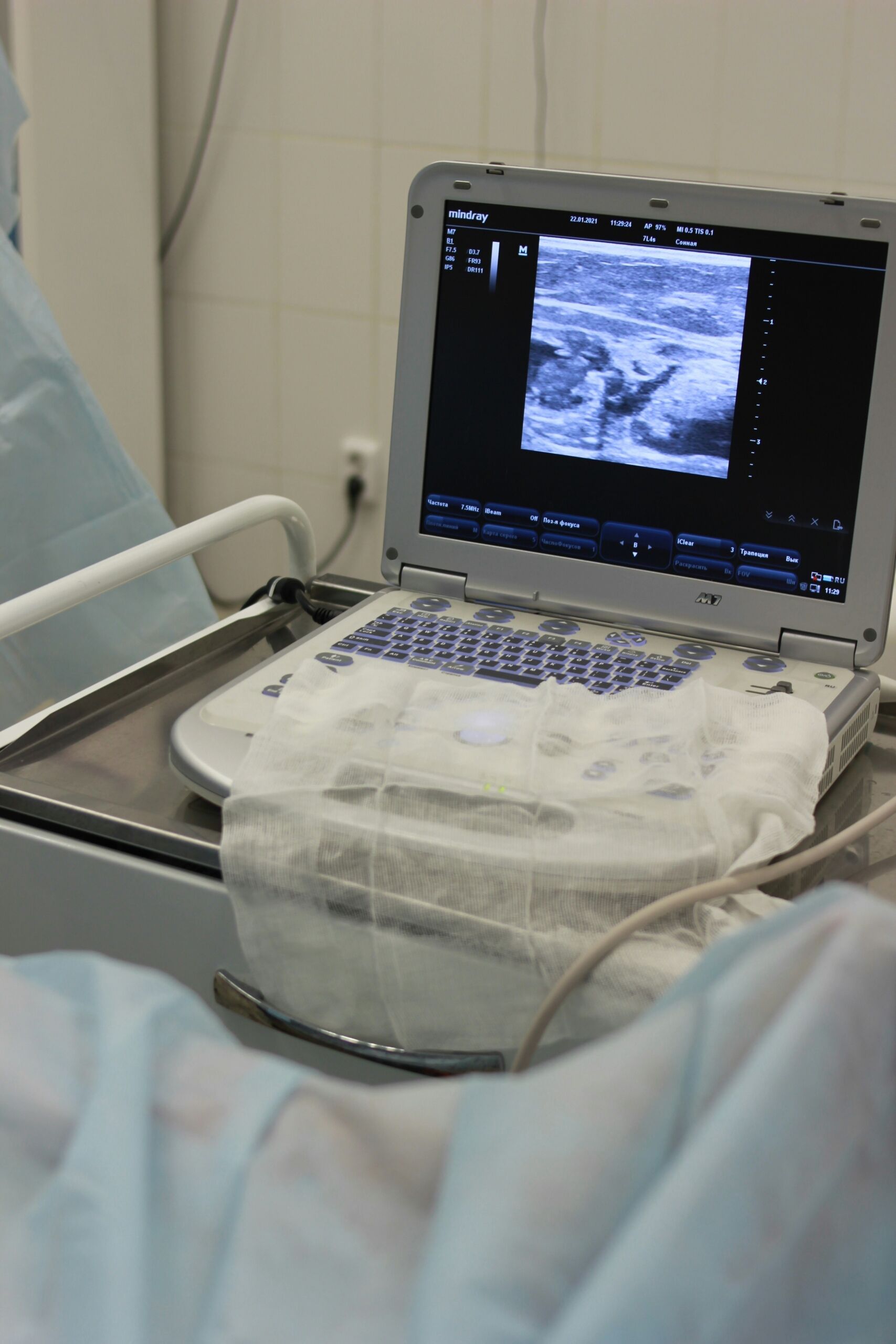 ultrasound