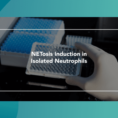 Web Thumbnail NETosis Induction in Isolated Neutrophils - Copy