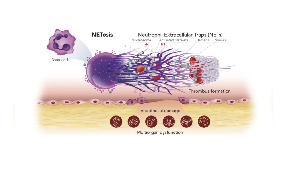 NETosis graphic Nov 2023