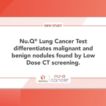 NTU study featured