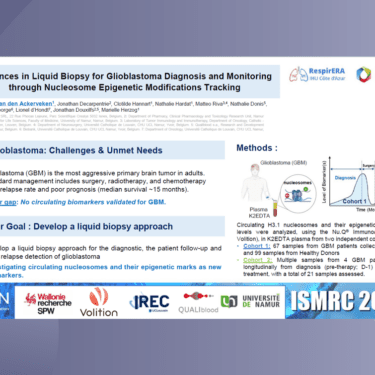 Advances in Liquid Biopsy for Glioblastoma Diagnosis and Monitoring